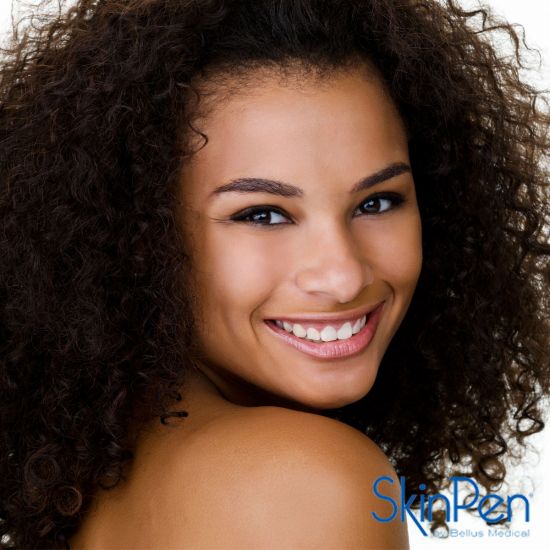 SkinPen Microneedling Full Face