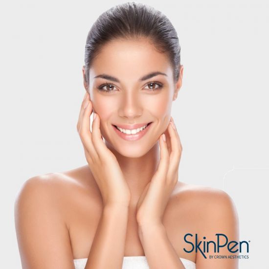 SkinPen® Microneedling