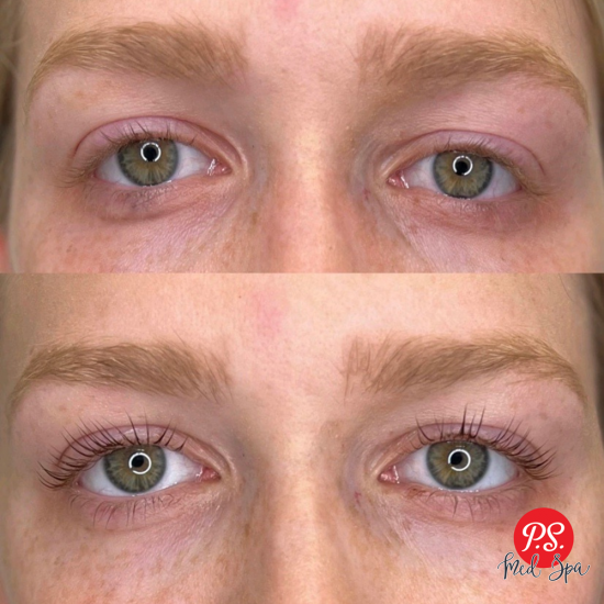Lash Lift & Tint