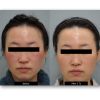 DermaV Clear and Tone