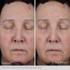 Obagi Elastiderm Lift Up & Sculpt Facial Moisturizer, before and after