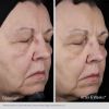 Obagi Elastiderm Lift Up & Sculpt Facial Moisturizer, before and after
