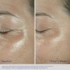 Obagi Elastiderm Firming Eye Cream, before and after results