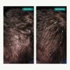 Nutrafol Men (3-Month Supply)
