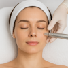 Dermal Needling With PRX