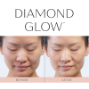 DiamondGlow + Dermaplane