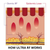 Ultra RF