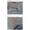 KeraLase Hair Restoration 