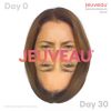Jeuveau™ Revive Medical Spa