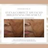 SkinMedica® Even & Correct Brightening Treatment
