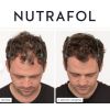 Nutrafol before and growing 3-months
