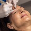 Microblading
