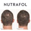 Nutrafol before and growing 3-months