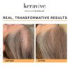 Keravive before and after