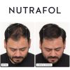 Nutrafol before and growing 3-months