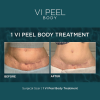 VI Peel Body