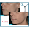 Lutronic Ultra™