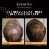 Keravive before and after