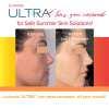 Lutronic Ultra™