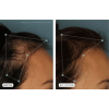 NUTRAFOL® for Women