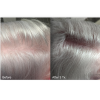 KeraLase Hair Restoration 