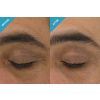 AOXEyeGel_ClinicallyProvenResults_BEFORE-AFTER
