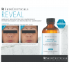 SkinCeuticals Advanced Corrective Peel