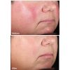 DermaV Clear and Tone