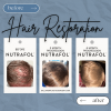 Hair Restoration Progression