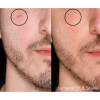 IPL Before and After