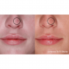 IPL Before and After