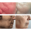 IPL Before and After