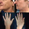 IPL Before and After