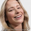 JUVÉDERM VOLBELLA® XC 