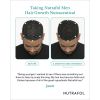 Nutrafol_Before_After_Photo_Jason1