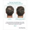 Nutrafol_Before_After_Photo_Mark1
