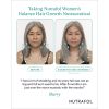 Nutrafol_Before_After_Photo_Sherry1