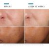 Phloretin-CF-with-Ferulic-Acid-635494328004-SkinCeuticals6