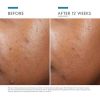 Phyt0_A_Brightening_Treatment_3606000584525_SkinCeuticals6