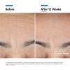 RGN PDP ALT 13 BEFORE + AFTER V3