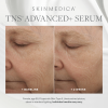 SkinMedica TNS® Advanced+ Serum