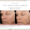 SkinMedica TNS® Advanced+ Serum