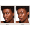 SKINVIVE™ by JUVÉDERM®