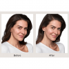 SKINVIVE™ by JUVÉDERM®