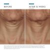 TRIPEPTIDE-R_NECK_REPAIR_SkinCeuticals7