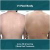 VI back