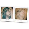 Laser Tattoo Removal  Before & After Two