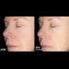 skinbetter Science Alto Defense Serum™ Before & After