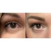 anteageeye