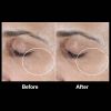 SkinMedica® HA5 Rejuvenating Hydrator Before & After